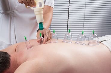 Cupping Therapy Services in Churchgate