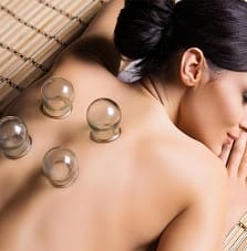 Cupping Services